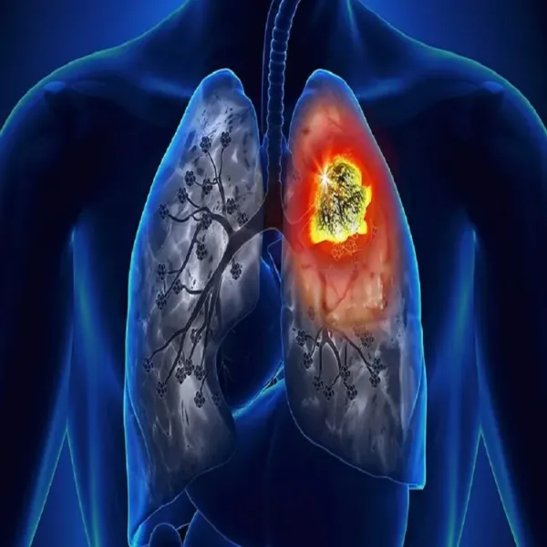 cancer 32000 cases jammu kashmir 1