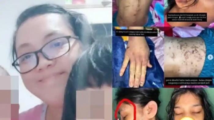 ASN BPK Olfit Ariani Purba dilaporkan ke Polres Bogor atas dugaan penganiayaan terhadap ART hingga luka di kepala, telinga, dan punggung. Suami pelaku disebut pernah mengalami kekerasan.