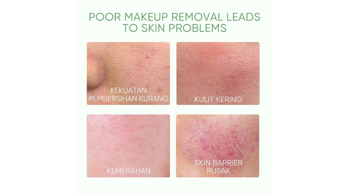 SKINTIFIC Mugwort Purifying Micellar Water