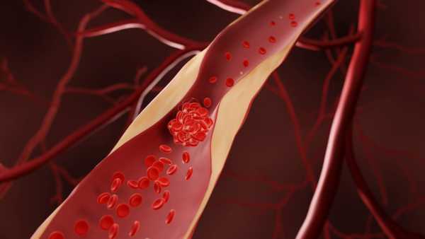 If there is blockage in the heart then these symptoms are definitely visible, the doctor told