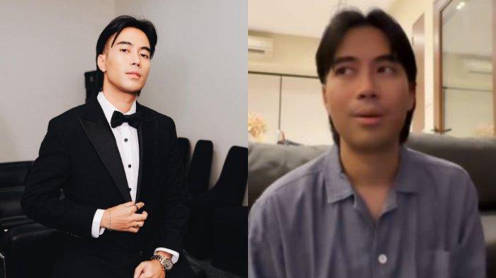 Vidi Aldiano banjir dukungan usai bongkar efek kemoterapi yang dijalaninya, tetap aktif beraktivitas meski rela menahan sakit.