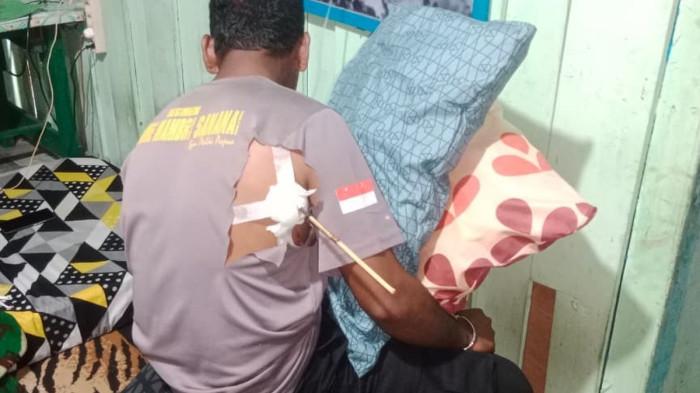 RICUH DOGIYAI - Seorang personel Kepolisian Resor (Polres) Dogiyai terkena anak panah dalam kericuhan oleh sekelompok warga pada Selasa (31/3/2026). (dok. Polda Papua Tengah)