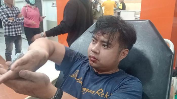 BUS TERGULING - Michel Gilbert, salah satu penumpang bus yang ikut menjadi korban bus terguling di ruas Tol Jombang-Mojokerto, KM 687, Desa Kedunglosari, Kecamatan Tembelang, Kabupaten Jombang, Jawa Timur pada Kamis (2/4/2026). Ia menduga sopir mengantuk atau sedang menghindari sesuatu.