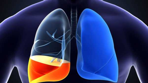 How dangerous is it to fill the lungs with water, why does this happen, know from experts