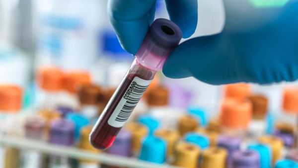 How dangerous is increase in protein in blood test? What disease is this a symptom of