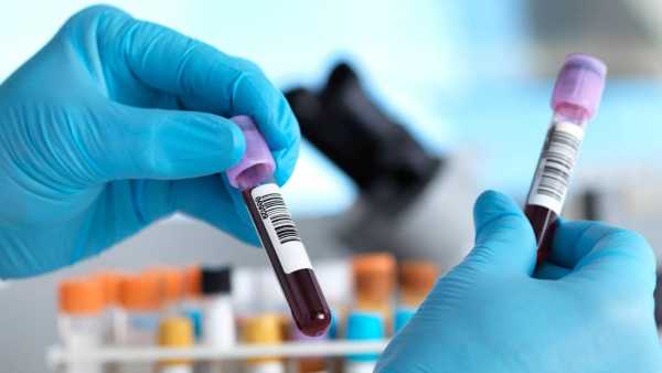Which diseases are detected by blood test? Learn from experts
