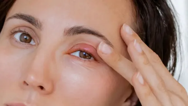 eye pain