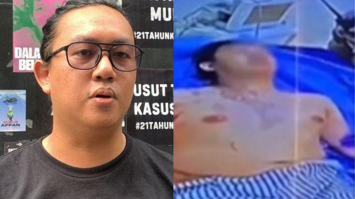 ANDRIE YUNUS - Foto Andrie Yunus ketika aktif menyuarakan kepentingan rakyat (kiri) dan kondisinya setelah disiram air keras saat jalan pulang (kanan), Selasa (30/3/2026). Dua pekan setelah disiram air keras, kondisi Andrie Yunus belum juga membaik. Aktivis KontraS itu masih berjuang di ruang perawatan intensif dalam kondisi kritis, sementara empat oknum TNI yang diduga terlibat kini telah ditahan.