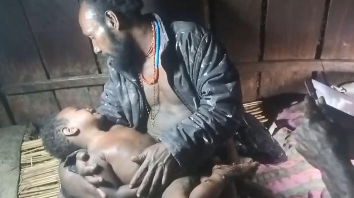 DARURAT MILITER - Foto korban seorang anak kecil yang di gendong ayahnya karena operasi militer di Distrik Sinak, Kabupaten Puncak, Papua Tengah yang terjadi pada Senin, (14/04/2026).