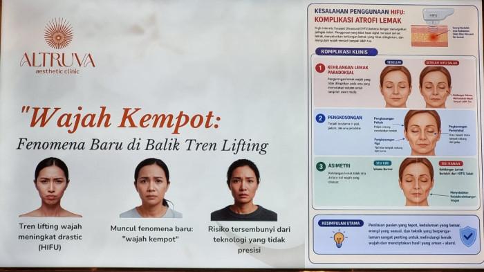 Materi paparan dari dr. Aldisa terkait fenomena Wajah Kempot