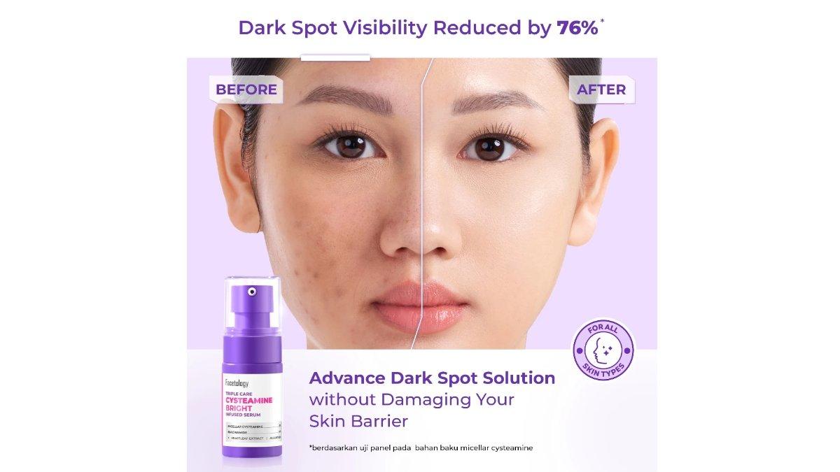 Facetology Triple Care Cysteamine Bright Infused Serum