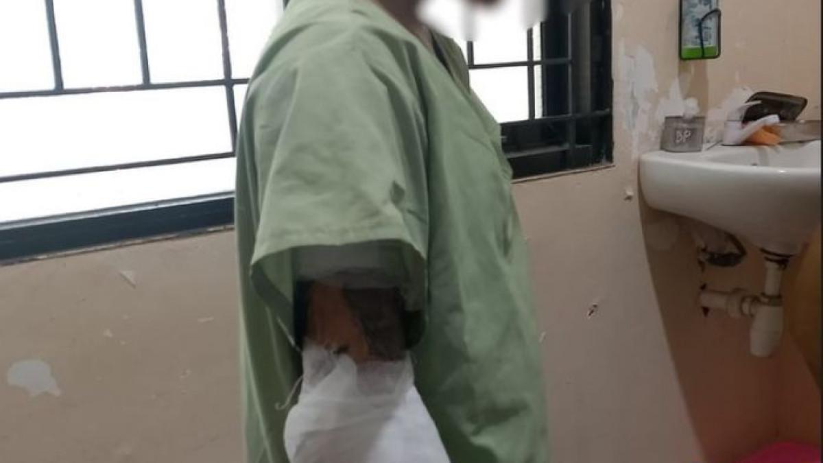 KEKERASAN ANAK - Remaja di Semarang dibakar paman karena tak mau mandi.