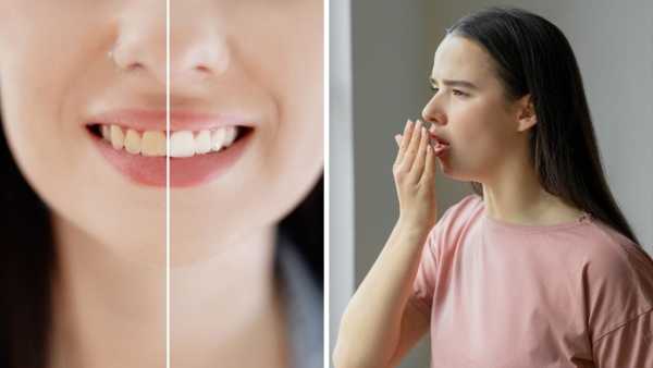 Baking Soda Uses For Good Oral Health