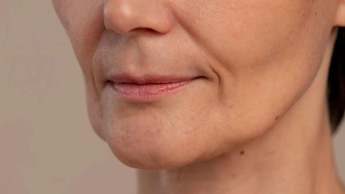 Ilustrasi penuaan dini pada kulit, bisa diatasi dengan rajin menggunakan skincare yang mengandung ceramide.