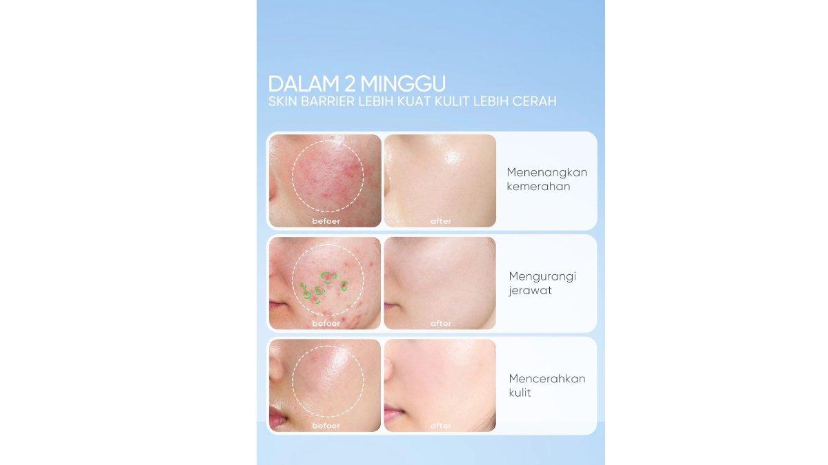 SKINTIFIC ECTOIN Skin Cream Gel Moisturizer