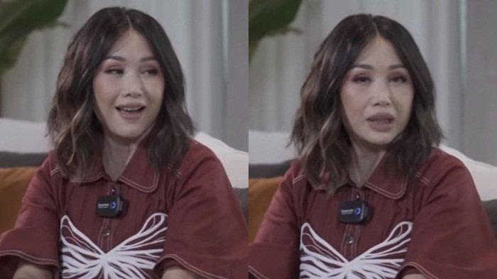 Titi Dj akhirnya ungkap alasan dan biaya operasi plastik antiaging dibagian wajahnya.