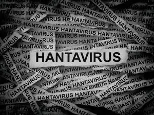 Hantavirus Juga Ada di RI, Kemenkes Catat 23 Kasus dalam 3 Tahun Terakhir