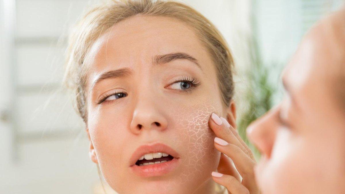 Pastikan kamu menghindari beberapa bahan skincare yang tidak cocok untuk kulit sensitif.