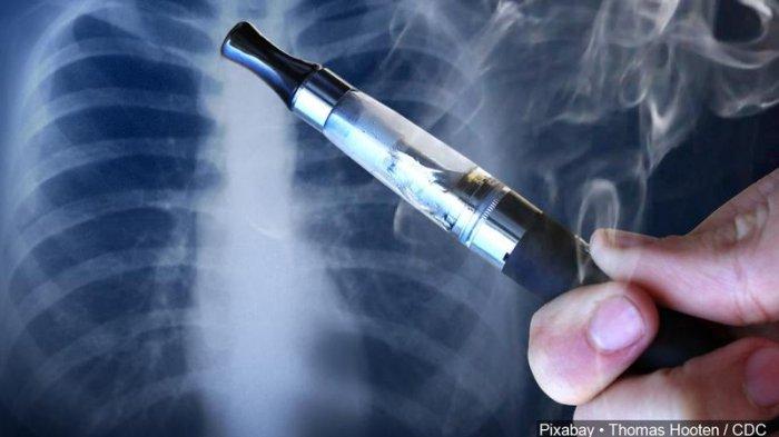 455 Orang Dilaporkan Menderita Penyakit Paru-paru Misterius Akibat Vape, 5 Orang Meninggal Dunia