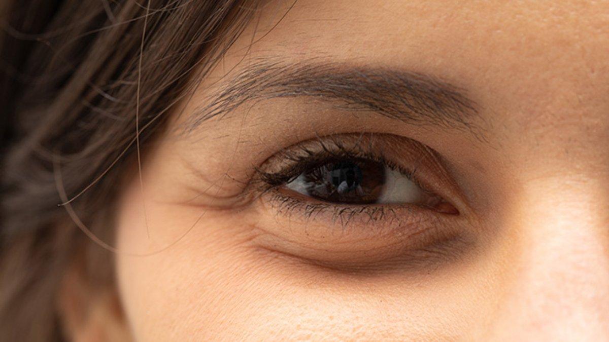Kantung mata bisa disamarkan dengan menggunakan es batu sebelum makeup.