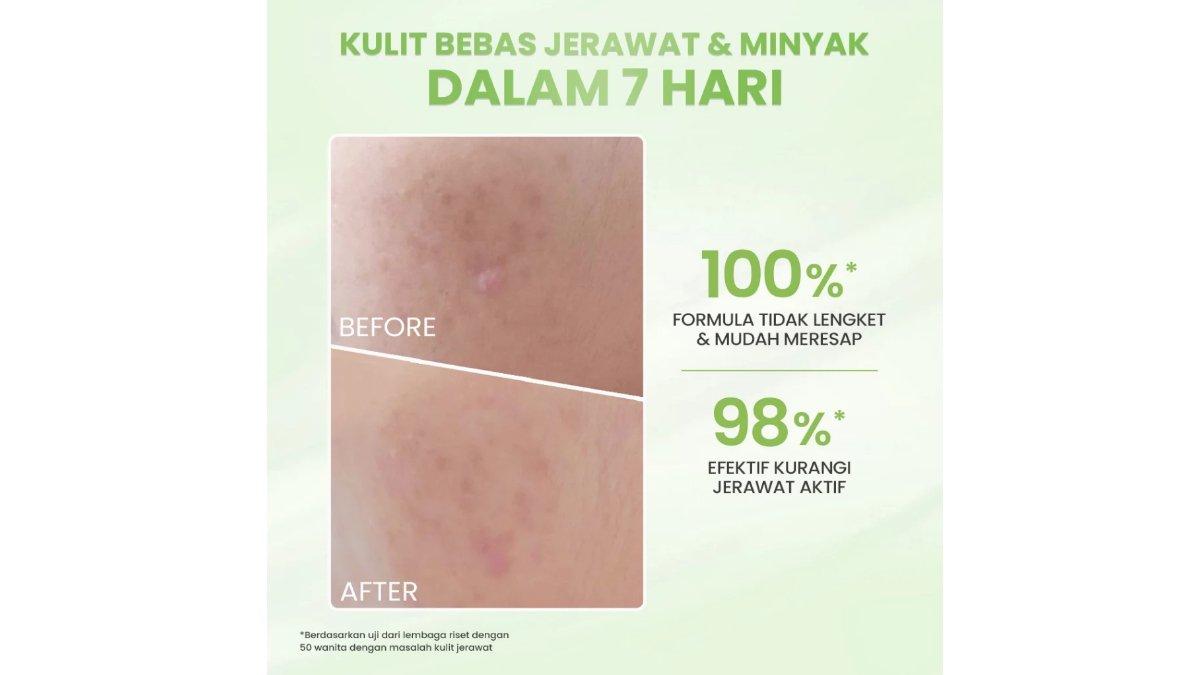 Hanasui Acne Expert Spot Gel