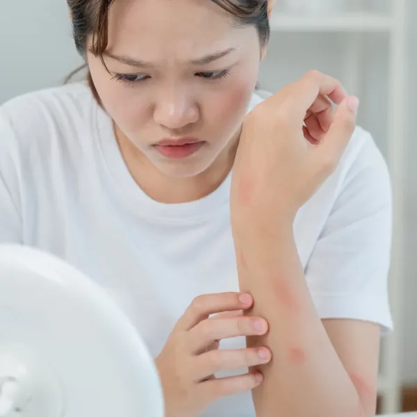 woman breaking out into hives at the thought of going to work