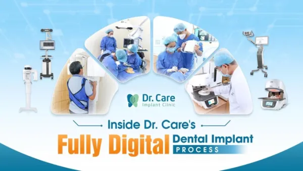Dr. Care outlines four-phase dental implant pathway for international patients in Vietnam