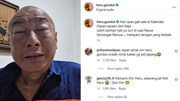 DISEMBUR KOBRA - Si Gundul bagikan kondisinya setelah kena semburan bisa ular kobra.