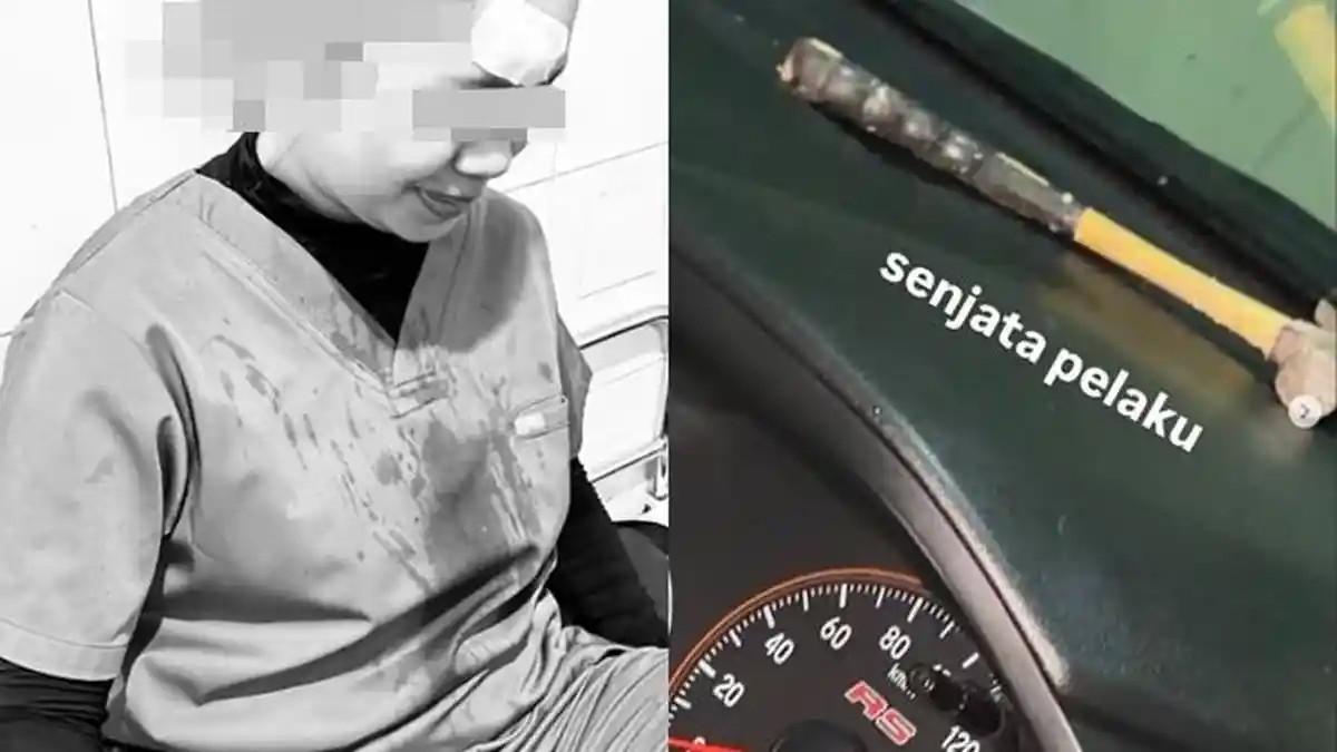 DOKTER DIANIAYA - Aksi kekerasan jalanan (road rage) yang berujung pada penganiayaan berat kembali terjadi di Kota Palembang. Seorang dokter gigi muda dilaporkan menjadi korban kebrutalan seorang pengendara tak dikenal di kawasan Kilometer 9 Palembang.
