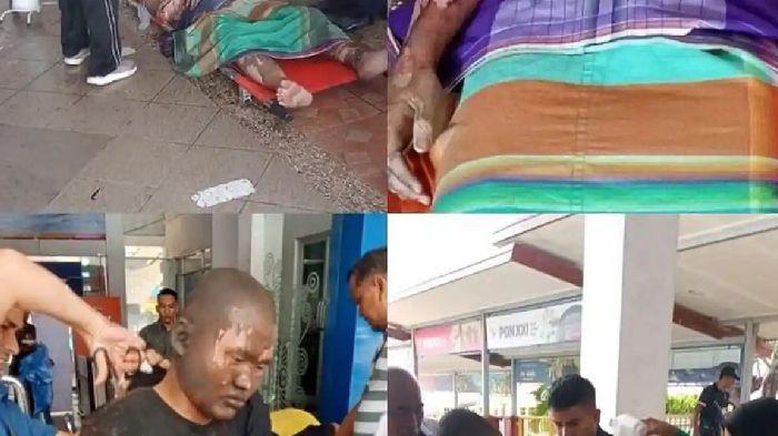 LEDAKAN - Sejumlah korban luka bakar akibat ledakan di ruang mesin KMP Aceh Hebat 2 menjalani penanganan medis darurat di Pelabuhan Ulee Lheue, Banda Aceh, Jumat (12/6/2026). seluruh korban langsung dievakuasi ke RSUD dr Zainoel Abidin (RSUDZA) Banda Aceh. (Serambinews.com/HO)