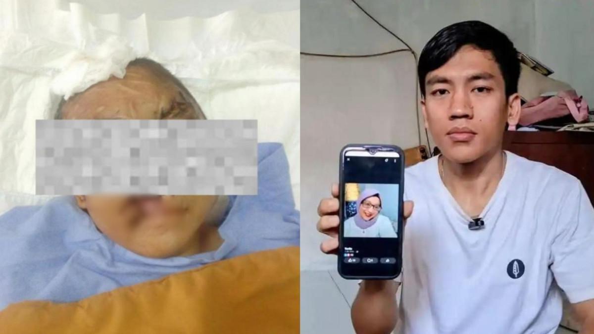 WANITA DISEKAP DI BANDUNG - Kolase potret kondisi YTR setelah dan sebelum disekap pacar selama tiga tahun. Alami luka berat terutama di bagian wajah dan kepala