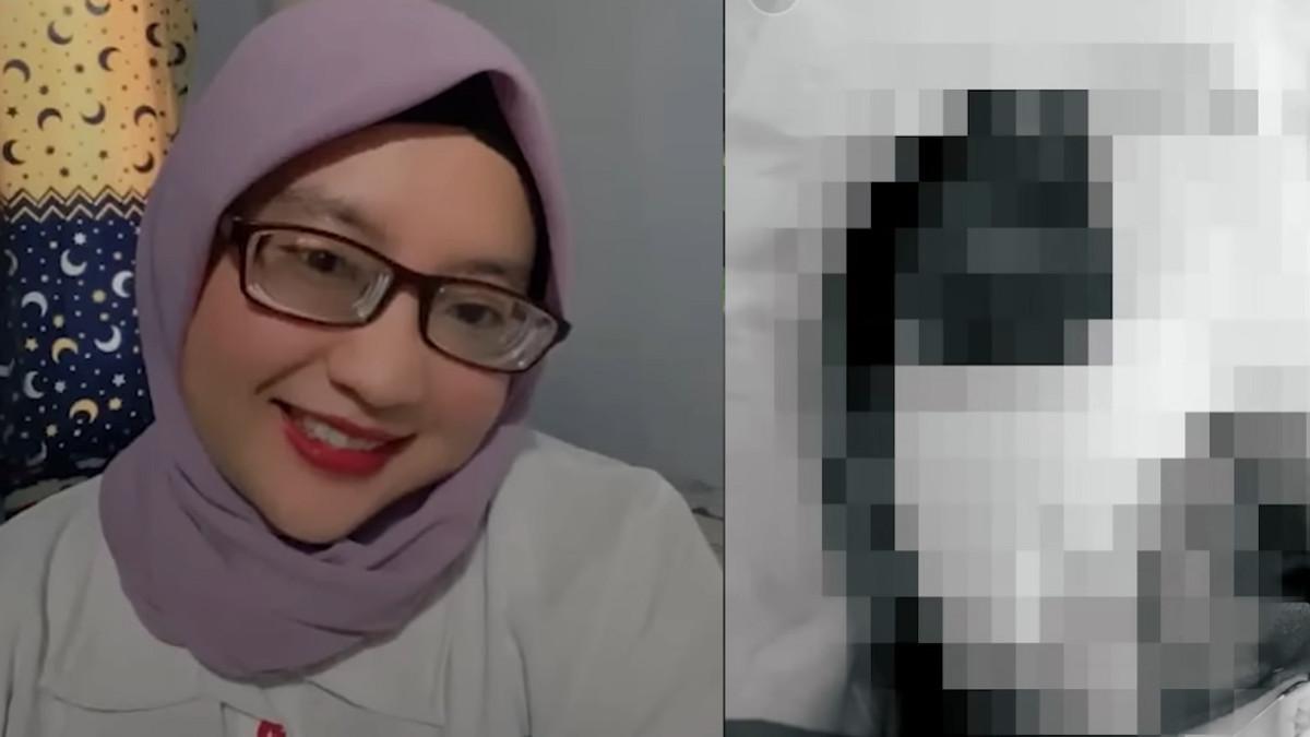 WANITA DISEKAP DI BANDUNG - Kolase potret kondisi YTR sebelum dan setelah disekap.