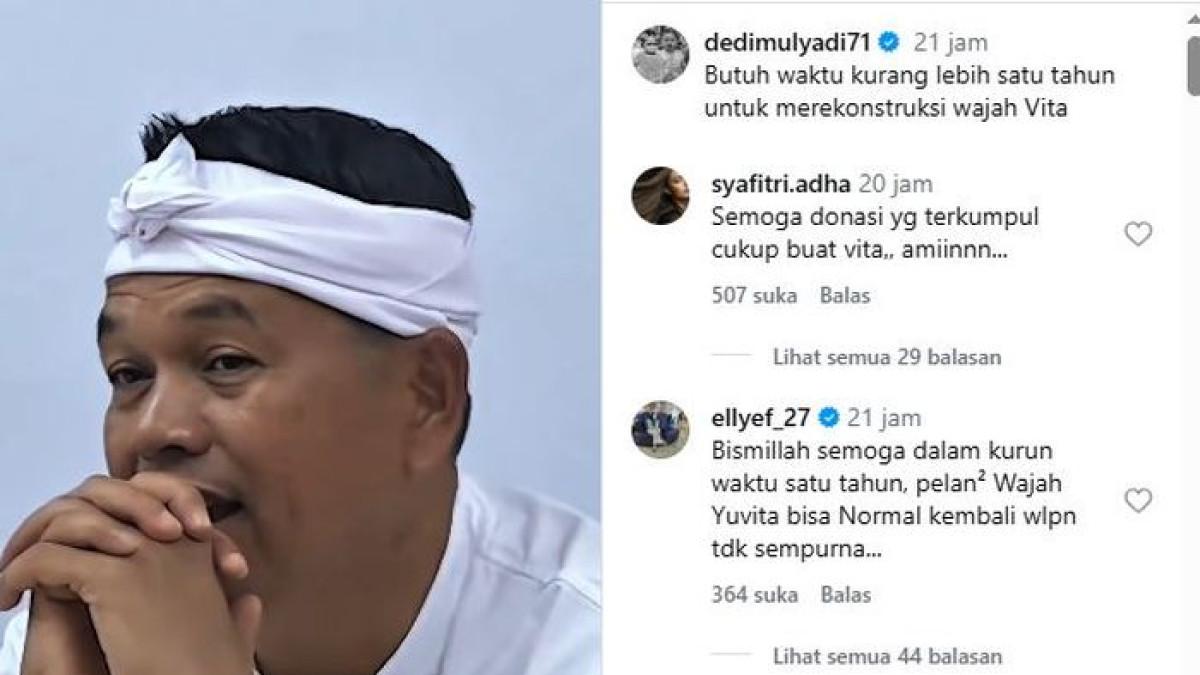 KONDISI KORBAN PENYEKAPAN - Dedi Mulyadi ungkap kondisi korban penyekapan Taufik Hidayat, sebut rekonstruksi wajah butuh waktu satu tahun.
