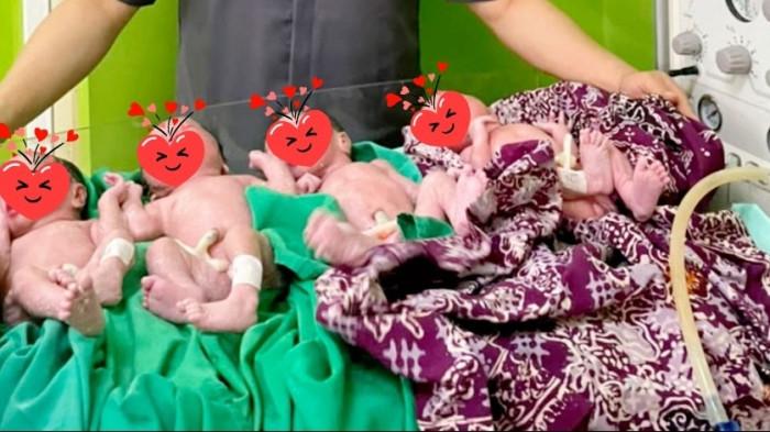 LAHIR EMPAT - Seorang ibu inisial HS (35 tahun), warga Tasokko, Kabupaten Mamuju Tengah, Sulawesi Barat persalinan kehamilan quadruplets (bayi kembar empat) melalui tindakan Sectio Caesarea (SC) pada Sabtu (4/7/2026) di RSUD Sulawesi Barat. Kehamilan quadruplets ini merupakan kehamilan anak kelima