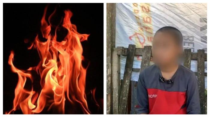 TIGA SANTRI DIBAKAR - Sahid Al Hudri (13) menceritakan peristiwa yang menyebabkan dirinya mengalami luka bakar hingga sebagian besar tubuhnya di Lombok Tengah, Kamis (4/6/2026).