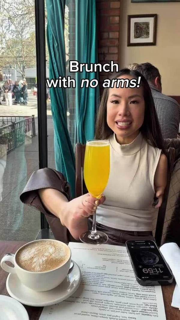 An American adoptive mother changed the life of an abandoned armless Vietnamese girl