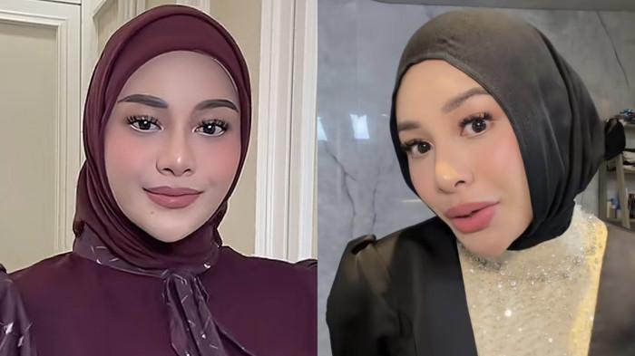 PERUBAHAN PADA WAJAH - Kolase perubahan pada bibir Aurel Hermansyah, dicapture Jumat (9/5/2026). Kini bibir natural istri Atta Halilintar banjir pujian.