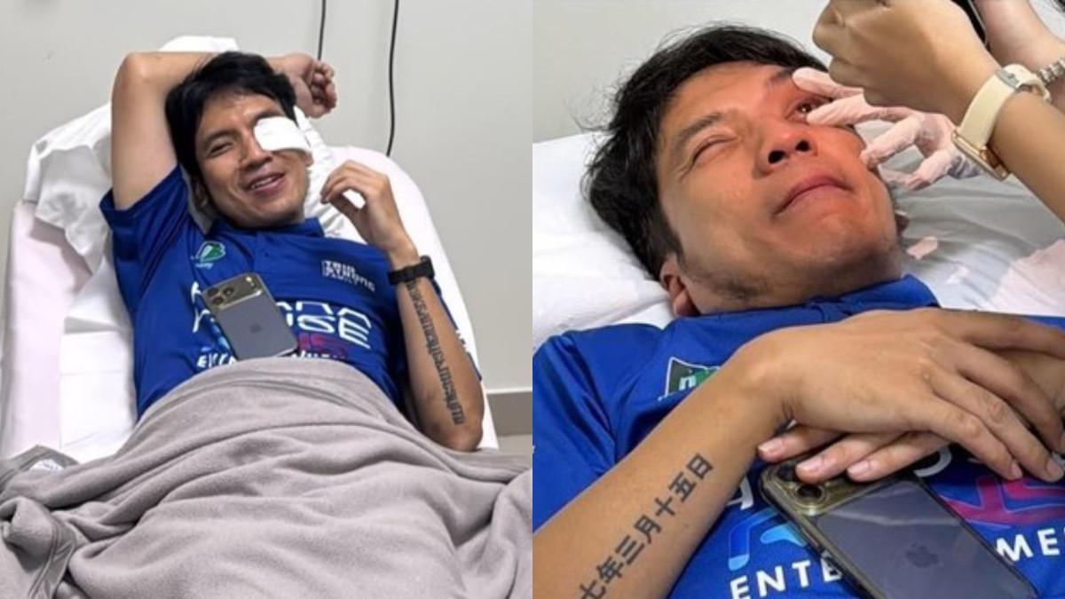 Desta ungkap kondisi setelah mengalami insiden matanya terkena bola padel. Penglihatan penglihatannya mulai berangsur pulih meski ada pendarahan.