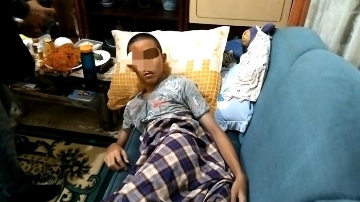 KORBAN JAMBRET -- Muzaffar Aqhari Ahmad (14) pelajar SMP yang alami luka-luka mulai dari kaki, tangan, hingga kepala usai melawan jambret  saat dijumpai di rumahnya Jalan Gersik, Lorong Amal Muslim, Kelurahan Sekip Jaya, Kecamatan Kemuning, Kamis (30/7/2026). Muzaffar mengatakan ia sempat tertarik puluhan meter sebelum terseret hingga luka-luka.