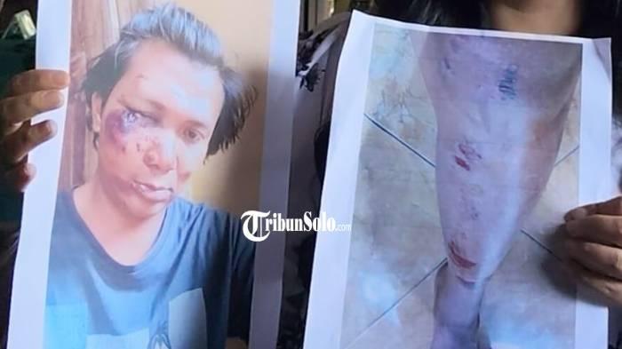 PENUH LUKA. Ruth Monica Ariyanto Kuasa Hukum Agung, saat ditemui TribunSolo.com, di PN Karanganyar, Senin (3/8/2026). Kliennya tiba-tiba diserang orang tidak dikenal.