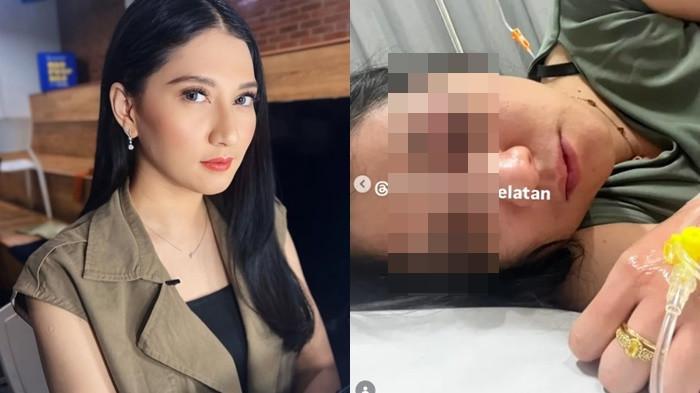 KORBAN PENGANIAYAAN - Artis Sali Irsalina melaporkan dugaan tindak penganiayaan terhadap dirinya yang terjadi di kawasan Fatmawati Raya, Cilandak, Jakarta Selatan, pada Sabtu (1/8/2026) dini hari ke Polres Metro Jakarta Selatan.  