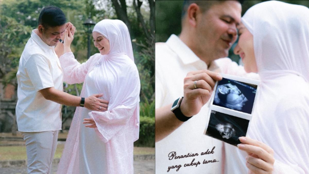 Irish Bella umumkan hamil anak Haldy Sabri. Ia pun memperlihatkan babybump hingga foto USG.