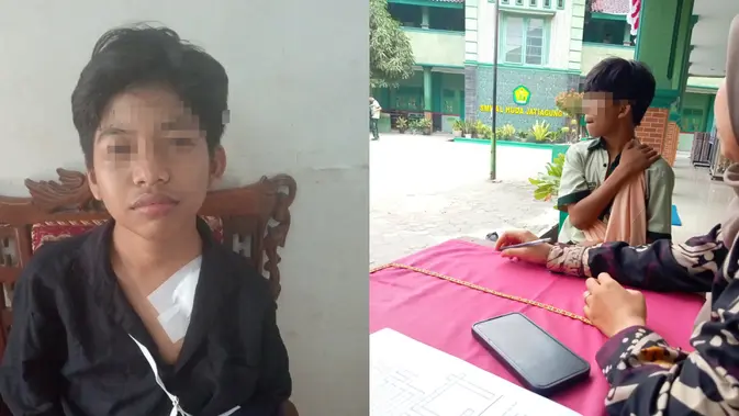 Seorang pelajar SMP di Kecamatan Jati Agung, Lampung Selatan, diduga menjadi korban perundungan dan penganiayaan oleh teman sekelasnya. (Liputan6.com/ Dok Ist)