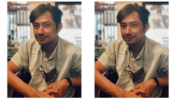 Revaldo kini tampil lebih sehat dan segar