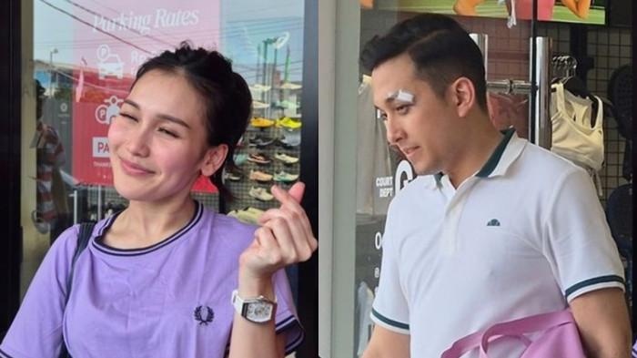 DAHI TERLUKA -- Kronologi pacar Ayu Ting Ting jatuh hingga pelipisnya terluka hingga dijahit