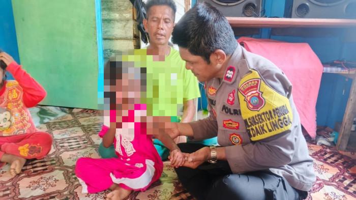 BOCAH ALAMI LUKA BAKAR - Aurel Amelia (6), seorang bocah perempuan mengalami musibah luka bakar, akibat tersiram minyak panas di kediamannya, Pulau Lipan RT 01 RW 01 Dusun III Desa Penuba, Kecamatan Selayar, Kabupaten Lingga, Kepulauan Riau, dapat kunjungan dari Polsek Daik, Sabtu (29/8/2026).