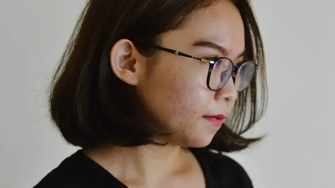 Ilustrasi moisturizer untuk kulit sensitif. (dok. unsplash/@audreyjackson)