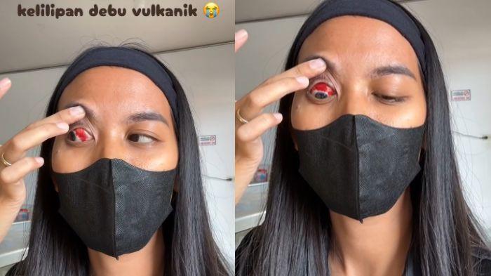kelilipan abu vulkanik imbas anak erupsi anak  Krakatau
